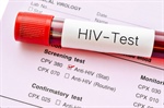 Nuove regole per i trapianti da donatore con infezione da HIV